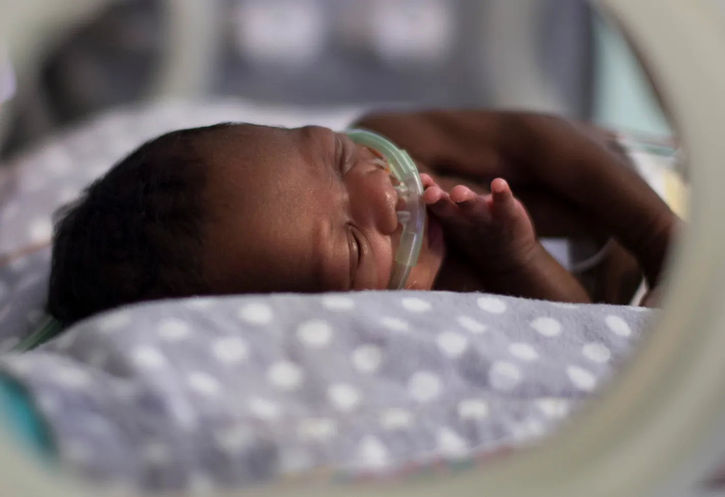 A premature baby is pictured lying in a giraffe NICU bed with a breathing tube.